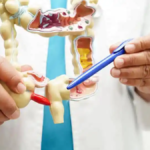 Doenças inflamatórias intestinais...